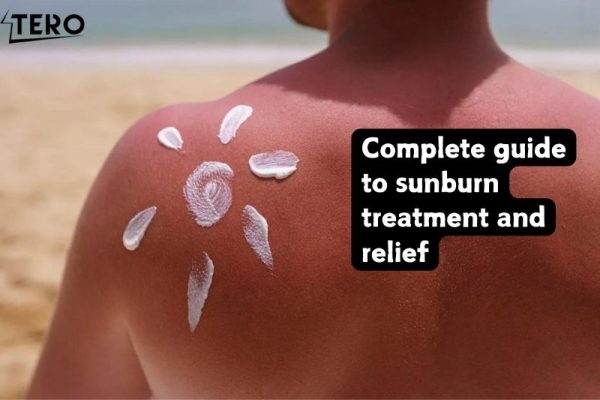 Complete guide to sunburn treatment and relief