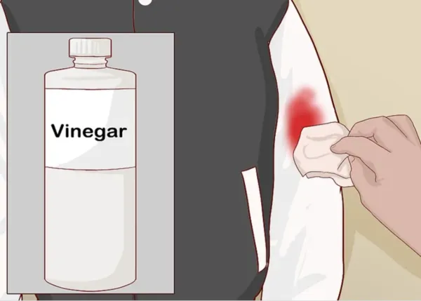 Removing blood stains from a baseball jacket with vinegar remains highly effective